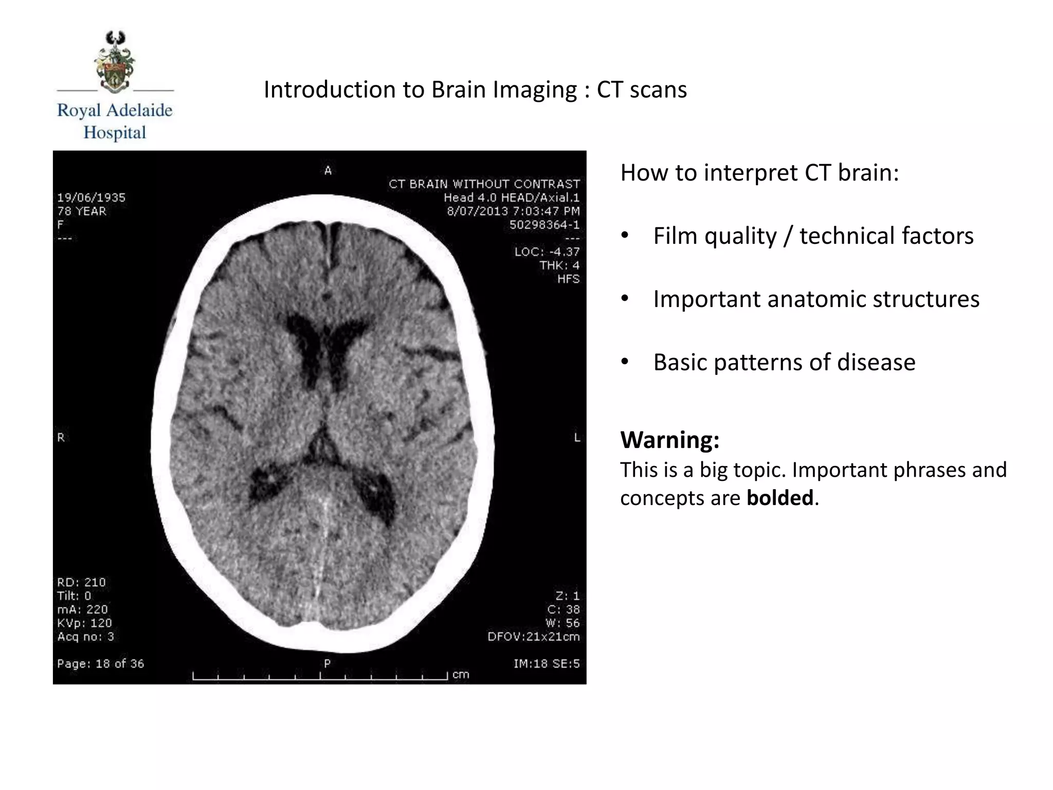 Introduction to Brain Imaging : CT scans
How to interpret CT brain:
• Film quality / technical factors
• Important anatomic structures
• Basic patterns of disease
Warning:
This is a big topic. Important phrases and
concepts are bolded.
 