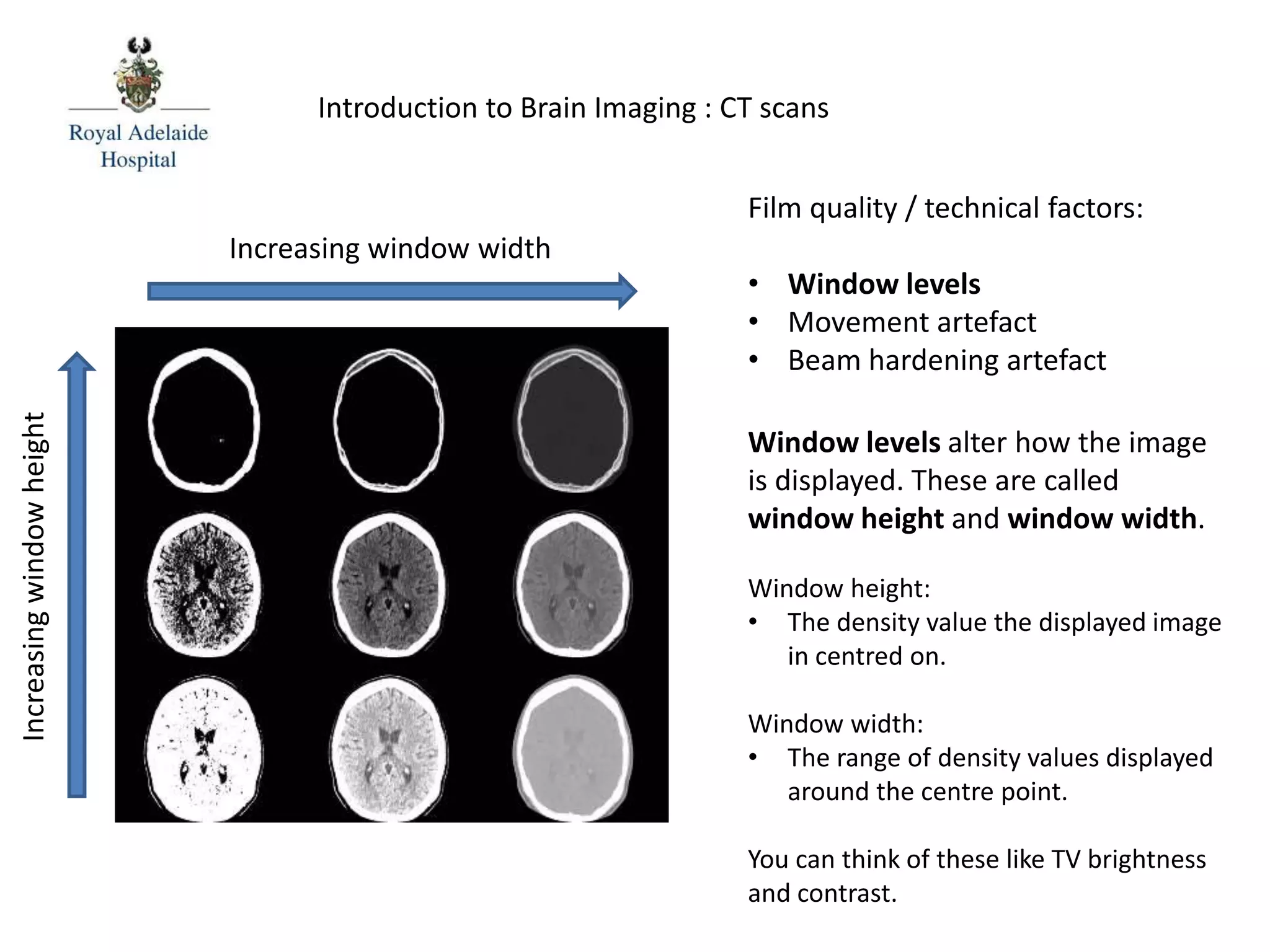 Film quality / technical factors:
• Window levels
• Movement artefact
• Beam hardening artefact
Window levels alter how the image
is displayed. These are called
window height and window width.
Window height:
• The density value the displayed image
in centred on.
Window width:
• The range of density values displayed
around the centre point.
You can think of these like TV brightness
and contrast.
Introduction to Brain Imaging : CT scans
Increasing window width
Increasingwindowheight
 