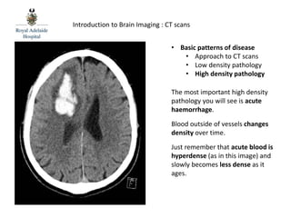 RAH Med 4 MHU - Brain CT 1 | PPTX