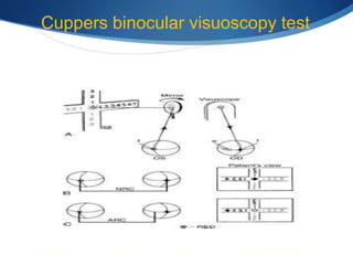 Cuppers binocular visuoscopy test
 