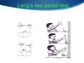 Lang’s two pencil test
 