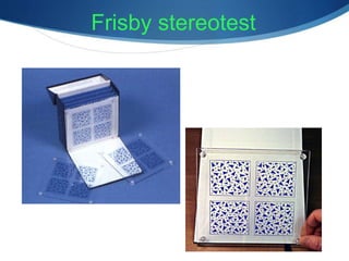 Frisby stereotest
 