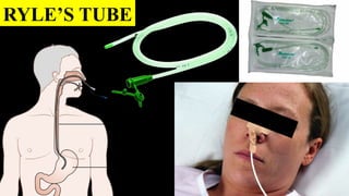 Fractured Ryles Tube INTRODUCTION TO CARDIOTHORACIC SURGERY DRAINAGE TUBES & BOTTLES.pptx