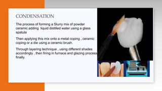 The process of forming a Slurry mix of powder
ceramic adding liquid distilled water using a glass
spatula
Then applying this mix onto a metal coping , ceramic
coping or a die using a ceramic brush.
Through layering technique , using different shades
accordingly , then firing in furnace and glazing process
finally.
CONDENSATION
 