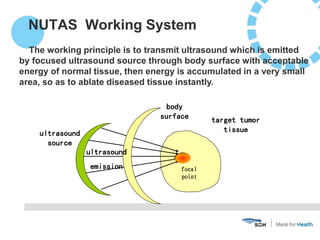 NUTAS Working System
focal
point
body
surface
ultrasound
source
target tumor
tissue
ultrasound
emission
The working princi...