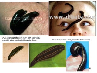 127
www.sciencephoto.com-350 × 234-Search by
imageHirudo medicinalis Hungarian leech Hirudo Medicinalis Anatomy Leech hirudo medicinalis
 