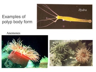 Examples of
polyp body form
Hydra
Anemones
 