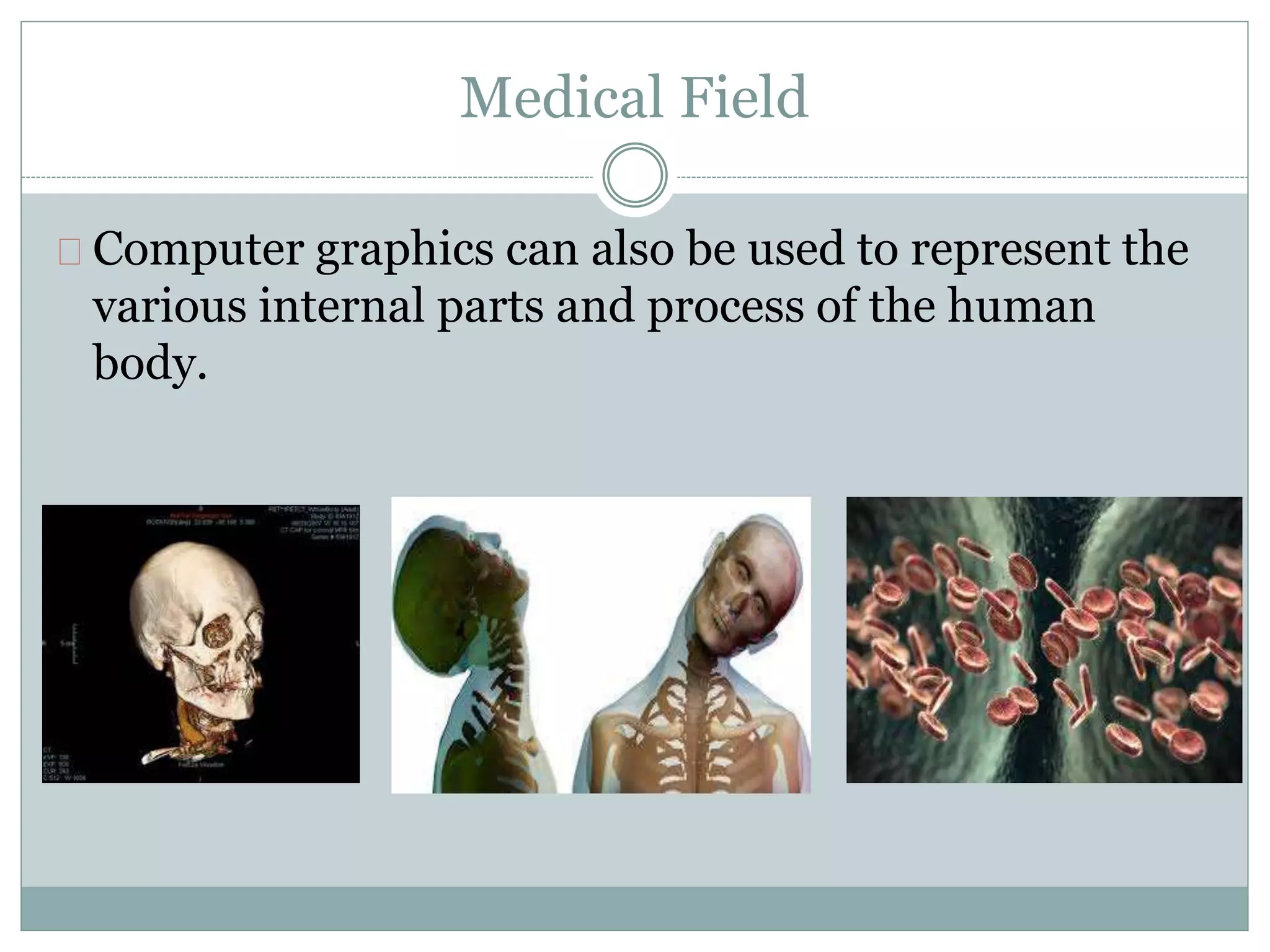 Medical Field
Computer graphics can also be used to represent the
various internal parts and process of the human
body.
 