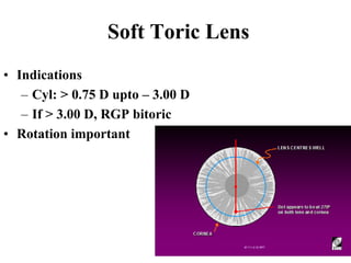 Introduction to contact lens.ppt