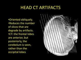 HEAD CT ARTIFACTS

•Oriented obliquely.
•Reduces the number
of slices that are
degrade by artifacts.
•CT: the frontal lobes
are anterior, but
posteriorly, the
cerebelum is seen,
rather than the
occipital lobes
 