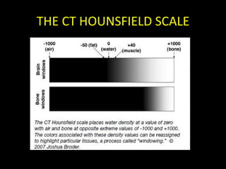 THE CT HOUNSFIELD SCALE
 