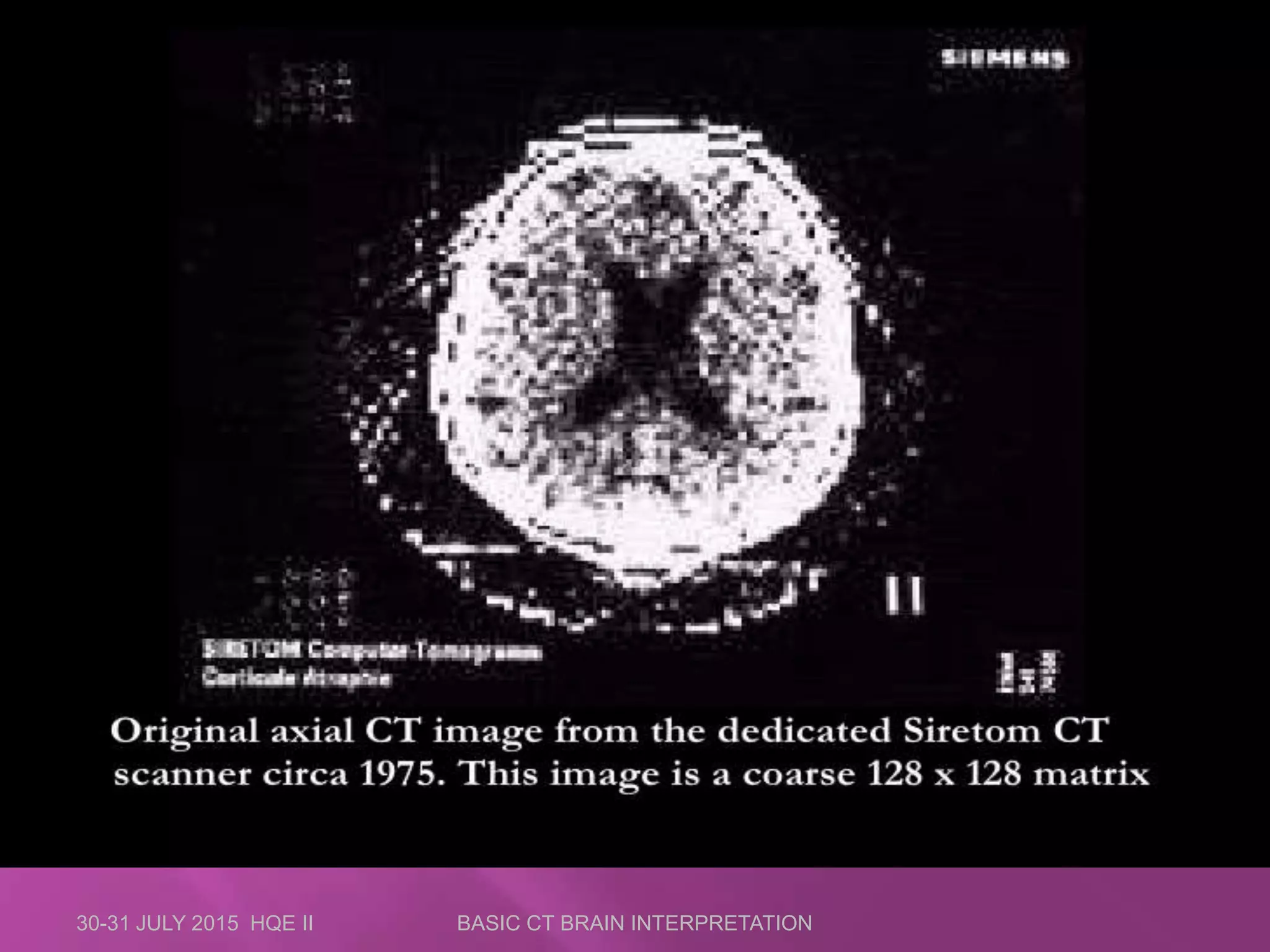 30-31 JULY 2015 HQE II BASIC CT BRAIN INTERPRETATION
 