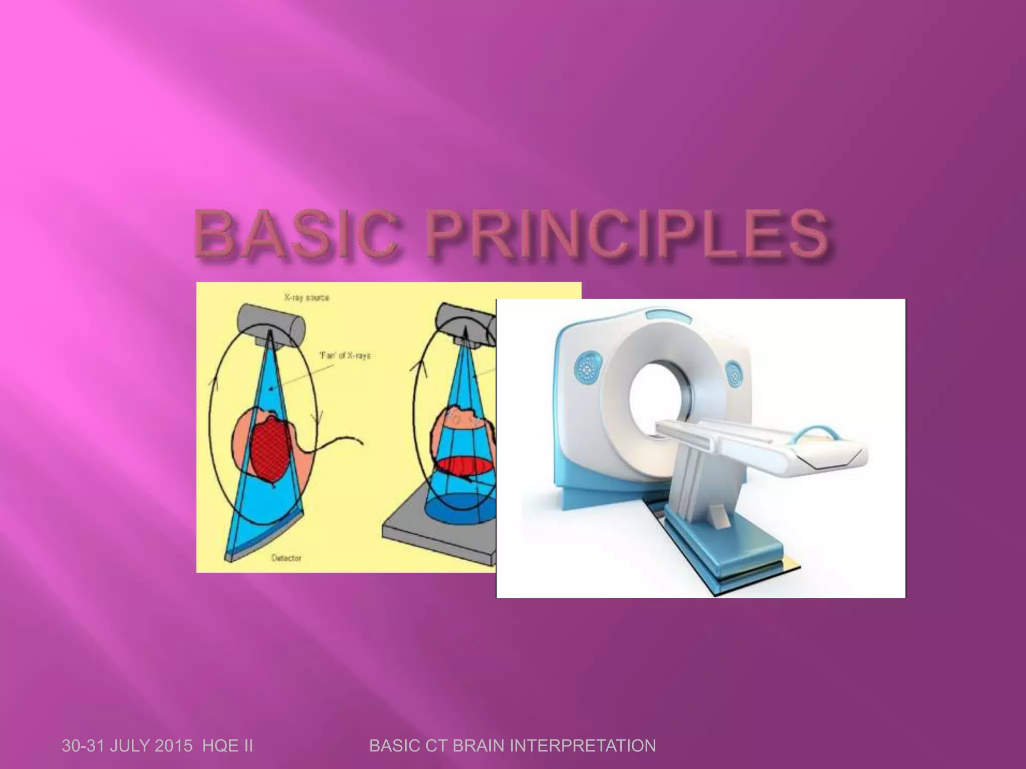 30-31 JULY 2015 HQE II BASIC CT BRAIN INTERPRETATION
 