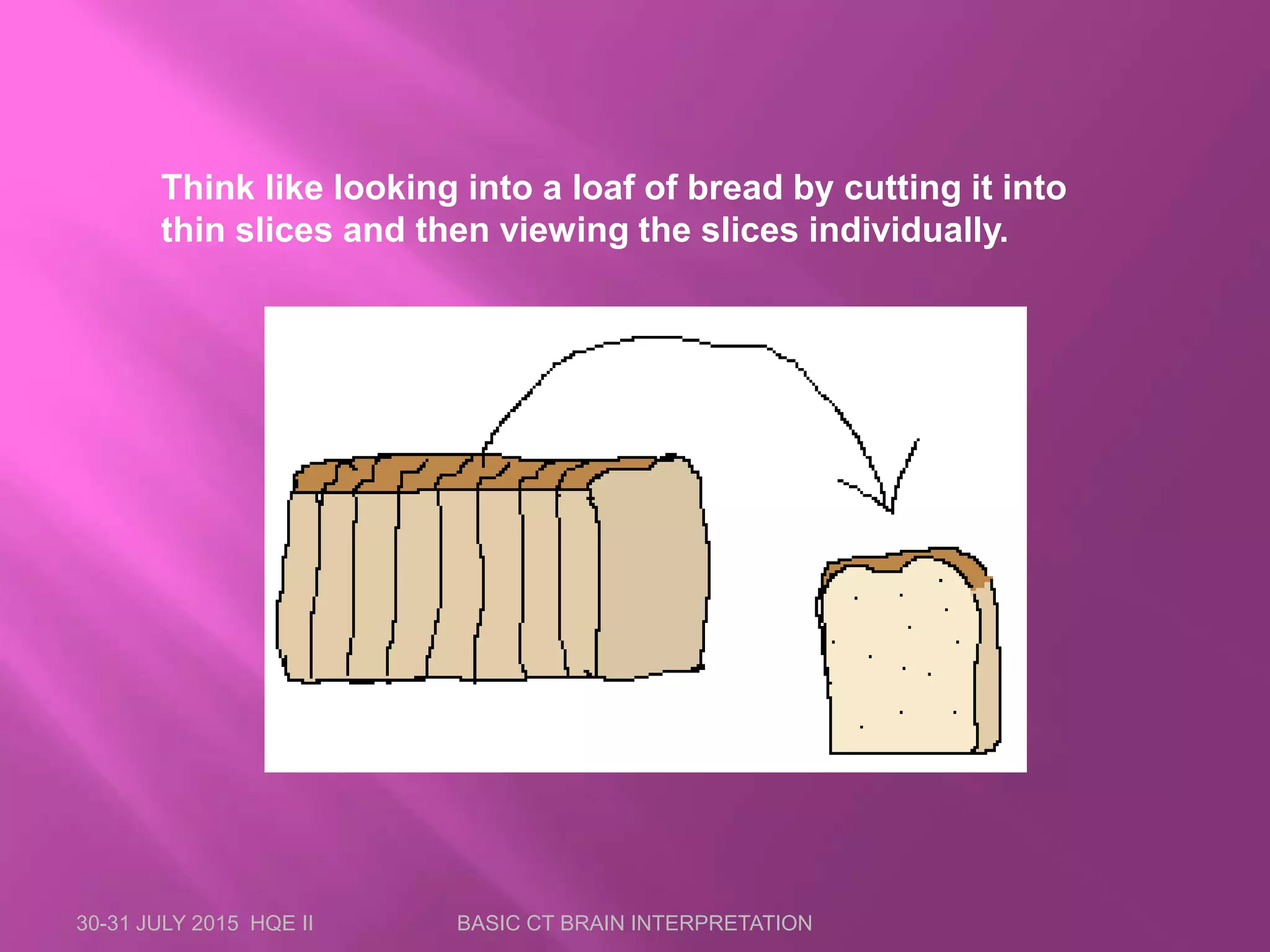 30-31 JULY 2015 HQE II BASIC CT BRAIN INTERPRETATION
Think like looking into a loaf of bread by cutting it into
thin slices and then viewing the slices individually.
 