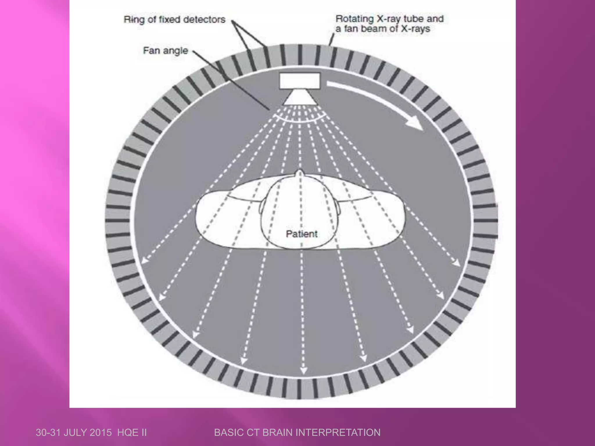 30-31 JULY 2015 HQE II BASIC CT BRAIN INTERPRETATION
 