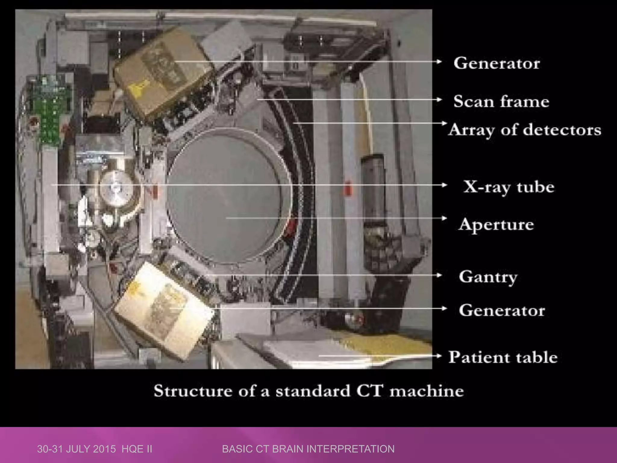30-31 JULY 2015 HQE II BASIC CT BRAIN INTERPRETATION
 