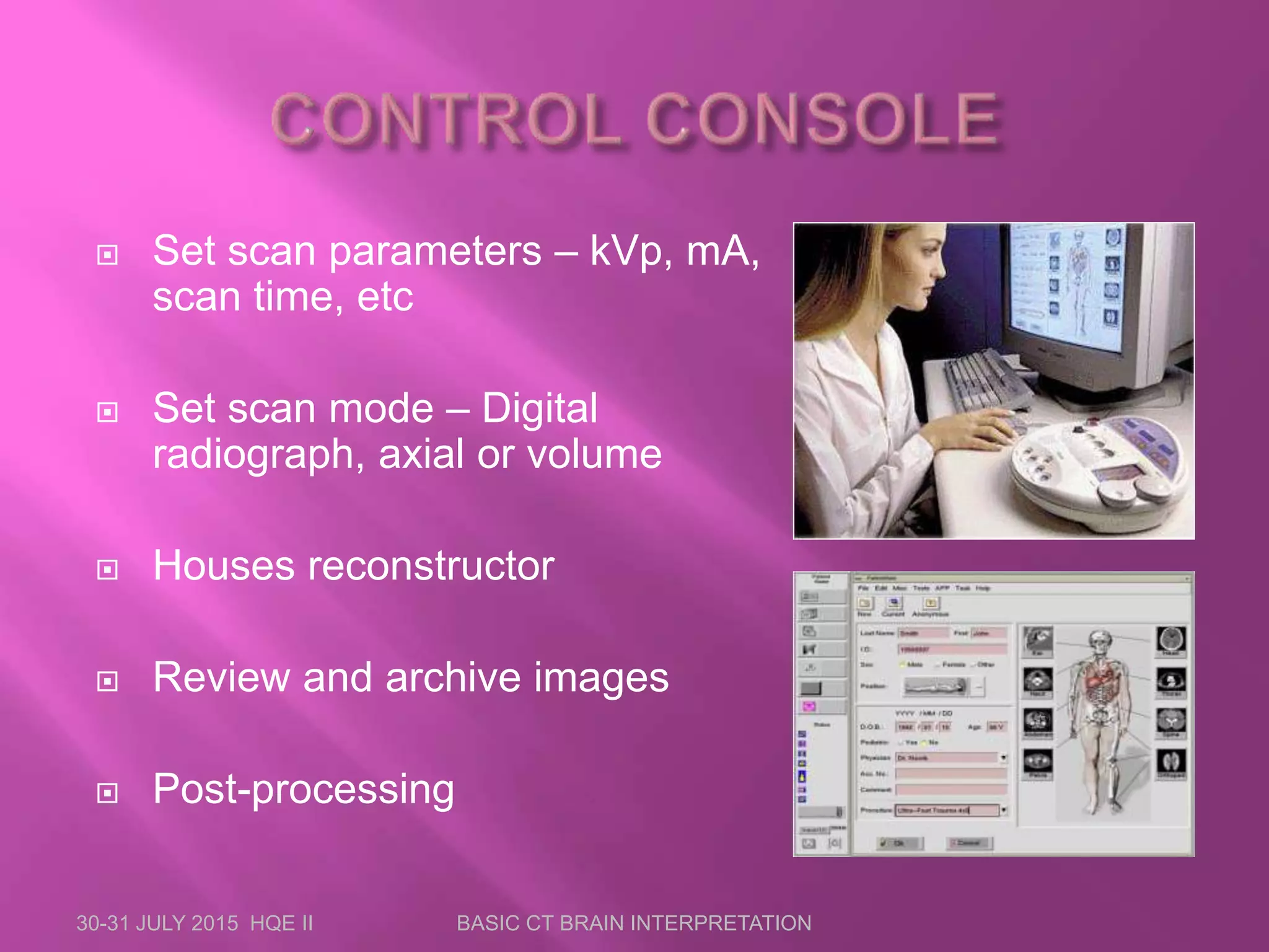  Set scan parameters – kVp, mA,
scan time, etc
 Set scan mode – Digital
radiograph, axial or volume
 Houses reconstructor
 Review and archive images
 Post-processing
30-31 JULY 2015 HQE II BASIC CT BRAIN INTERPRETATION
 