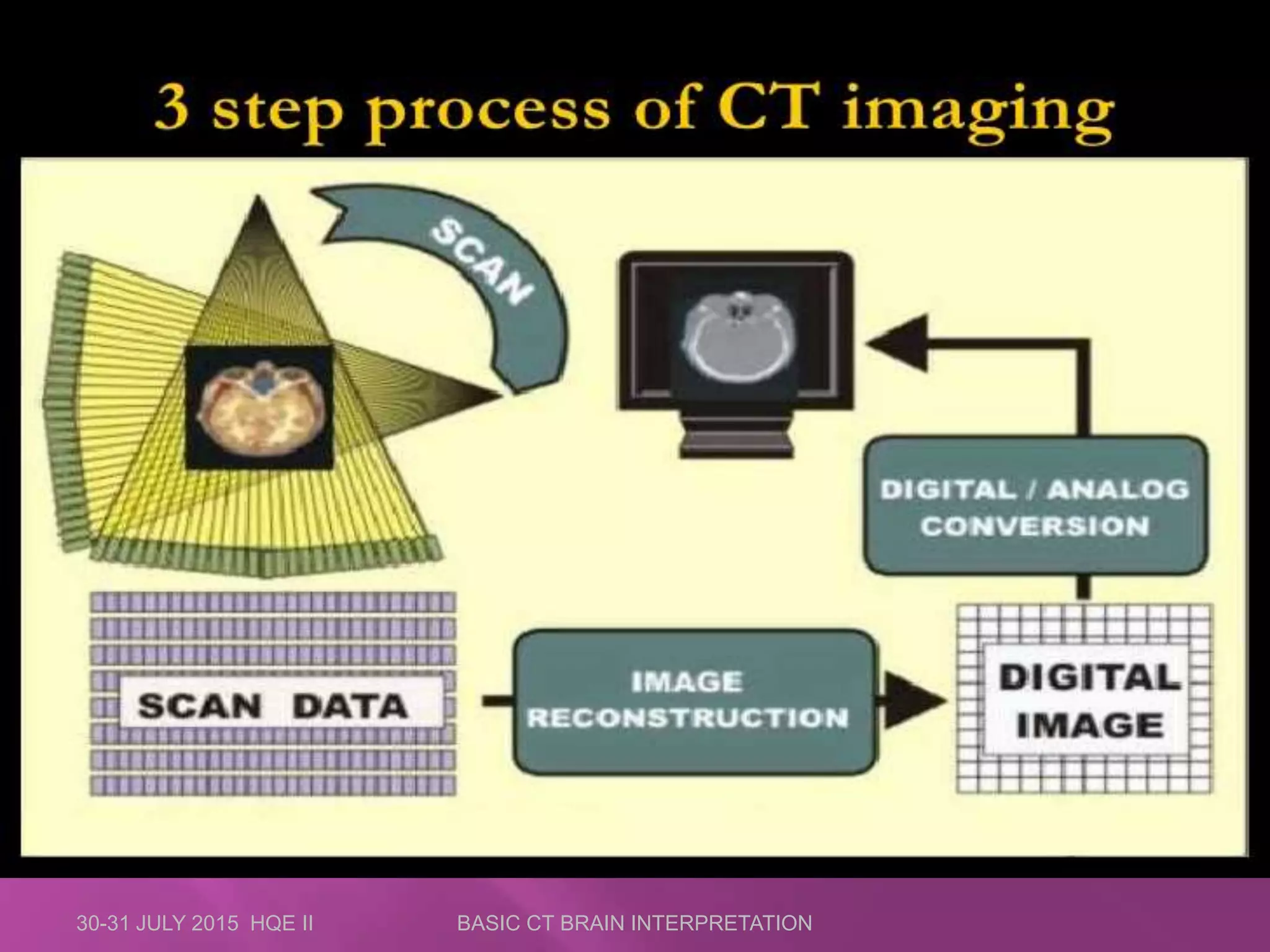 30-31 JULY 2015 HQE II BASIC CT BRAIN INTERPRETATION
 