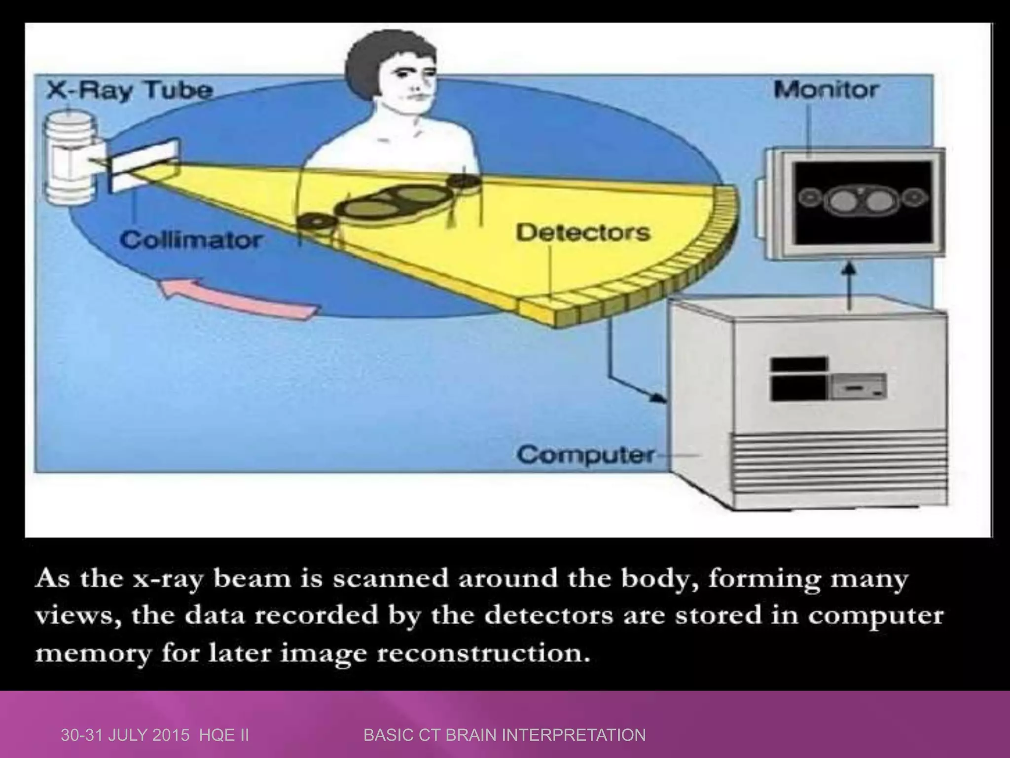 30-31 JULY 2015 HQE II BASIC CT BRAIN INTERPRETATION
 