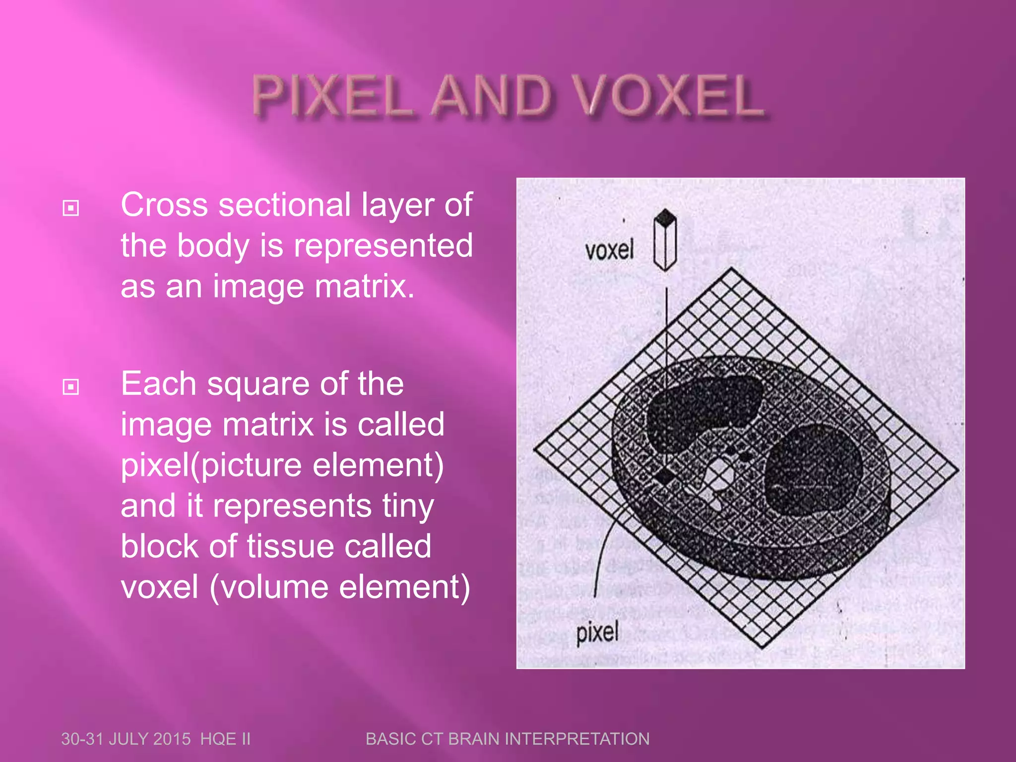  Cross sectional layer of
the body is represented
as an image matrix.
 Each square of the
image matrix is called
pixel(picture element)
and it represents tiny
block of tissue called
voxel (volume element)
30-31 JULY 2015 HQE II BASIC CT BRAIN INTERPRETATION
 