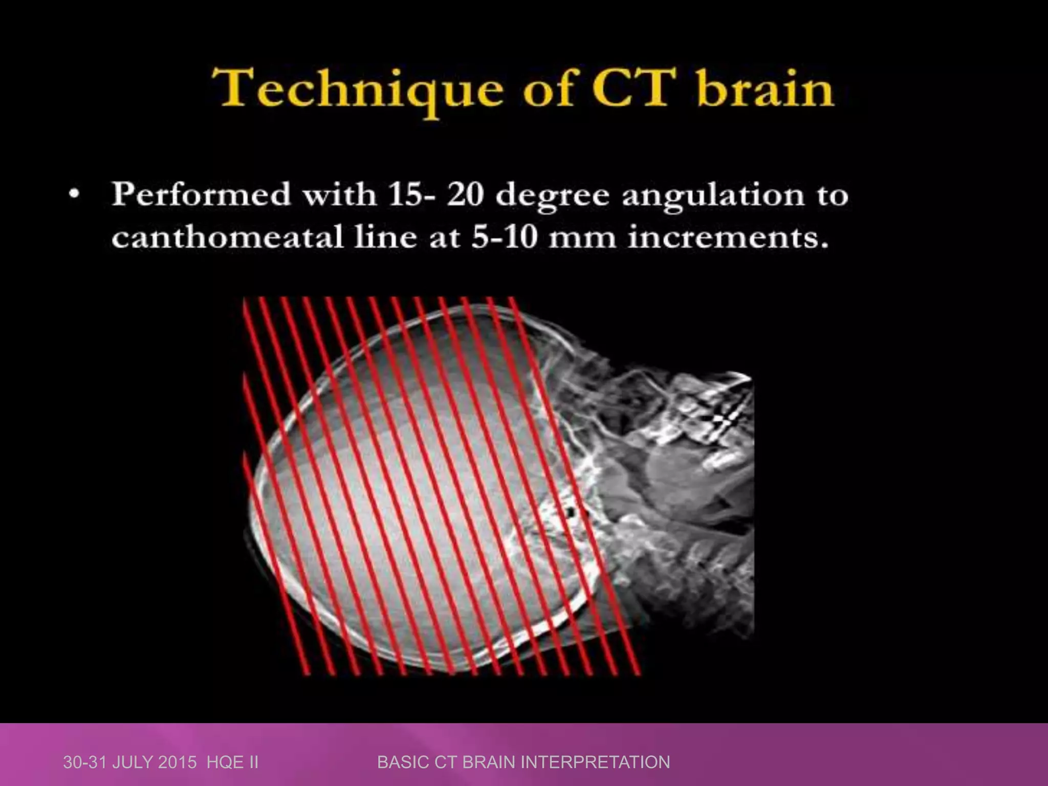 30-31 JULY 2015 HQE II BASIC CT BRAIN INTERPRETATION
 