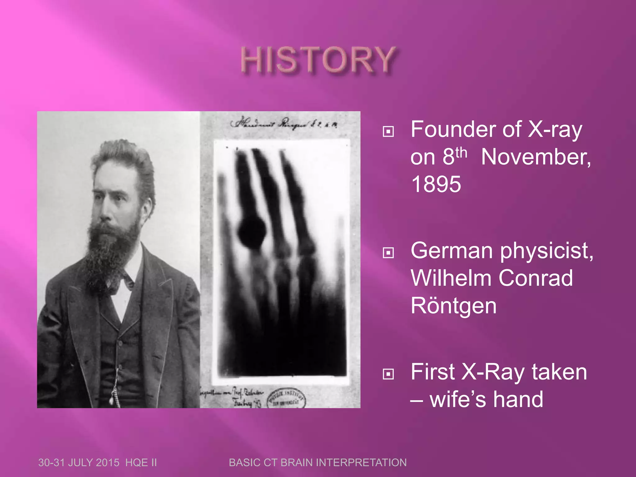  Founder of X-ray
on 8th November,
1895
 German physicist,
Wilhelm Conrad
Röntgen
 First X-Ray taken
– wife’s hand
30-31 JULY 2015 HQE II BASIC CT BRAIN INTERPRETATION
 
