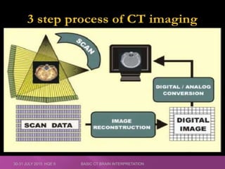 Introduction to CT Brain: The Basic Principles | PPTX