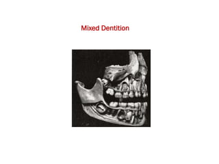 Mixed Teethmap Introduction to dental anatomy_221109_222300.pdf