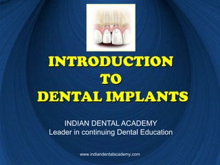 INTRODUCTIONINTRODUCTION
TOTO
DENTAL IMPLANTSDENTAL IMPLANTS
INDIAN DENTAL ACADEMY
Leader in continuing Dental Education
www.indiandentalacademy.com
 