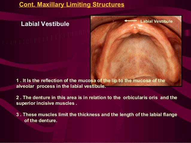 hamular notch