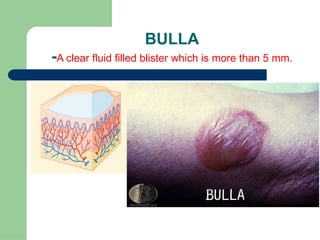 Bulla Photo Introduction to Dermatology powerpoint .pptx