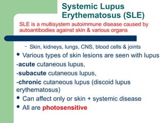 Sle Types Introduction to Dermatology powerpoint .pptx
