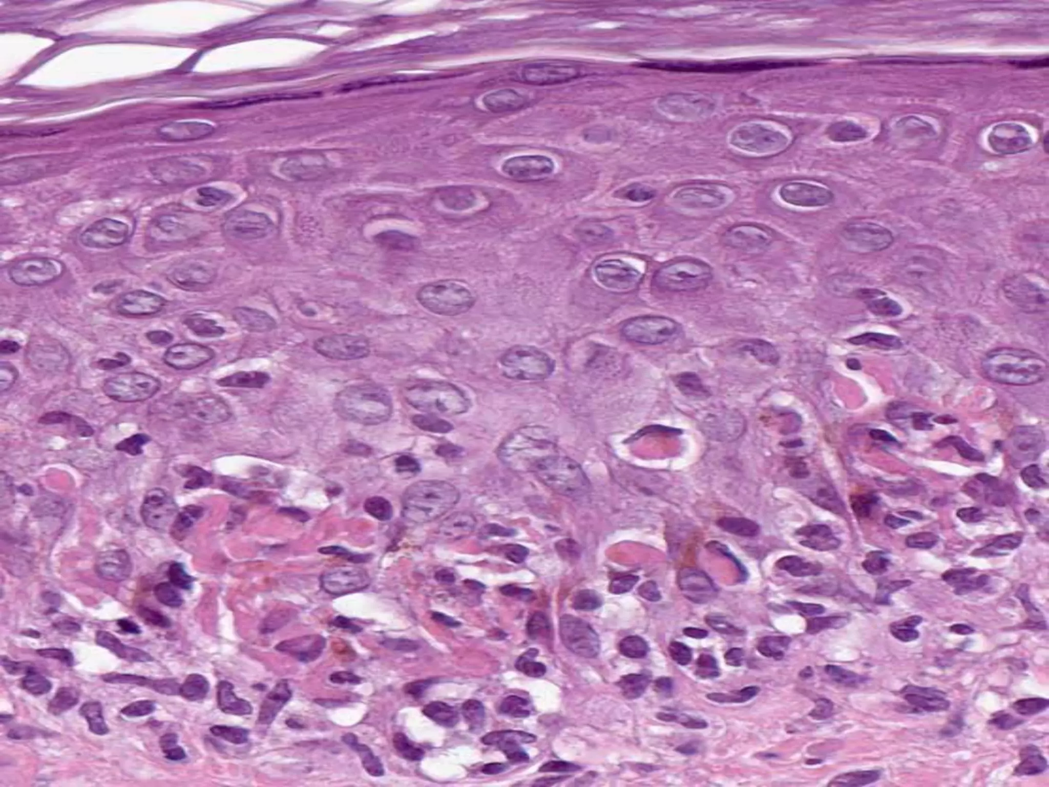 DERMATOPATHOLOGY TERMS