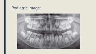 Pediatric Image:
 