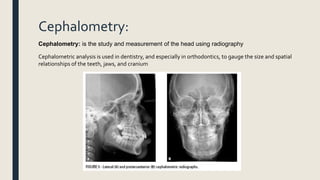 Cephalometry:
Cephalometry: is the study and measurement of the head using radiography
Cephalometric analysis is used in dentistry, and especially in orthodontics, to gauge the size and spatial
relationships of the teeth, jaws, and cranium
 
