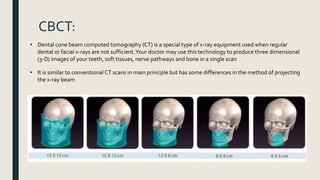 CBCT:
• Dental cone beam computed tomography (CT) is a special type of x-ray equipment used when regular
dental or facial x-rays are not sufficient.Your doctor may use this technology to produce three dimensional
(3-D) images of your teeth, soft tissues, nerve pathways and bone in a single scan
• It is similar to conventional CT scans in main principle but has some differences in the method of projecting
the x-ray beam
 