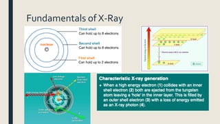 Fundamentals of X-Ray
 