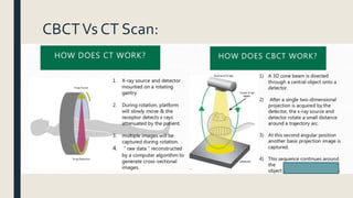 CBCTVs CT Scan:
 