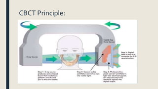 CBCT Principle:
 