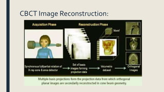 CBCT Image Reconstruction:
 