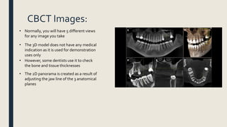 CBCT Images:
• Normally, you will have 5 different views
for any image you take
• The 3D model does not have any medical
indication as it is used for demonstration
uses only
• The 2D panorama is created as a result of
adjusting the jaw line of the 3 anatomical
planes
• However, some dentists use it to check
the bone and tissue thicknesses
 