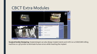 CBCT Extra Modules
Surgical Guides Designing: Implantologist can also design implant stents and mill it on a CAD/CAM milling
machine or a 3D printer to eliminate human errors while inserting the implant
 