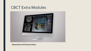 CBCT Extra Modules
Sleep Apnea and Airway Analysis
 