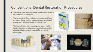 Conventional Dental Restoration Procedures
• The dentist then sends the dental impression to a dental
lab technician or dental lab
• The technician will then take the impression and flows
a gypsum dental stone or plaster to create a replica of
the patient's anatomy known as a dental cast
• The lab technician then waxes up and casts a metal
fixed restoration or substructure, and/or incrementally
places and bakes ceramic material for an esthetic
restoration
 