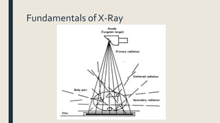 Fundamentals of X-Ray
 