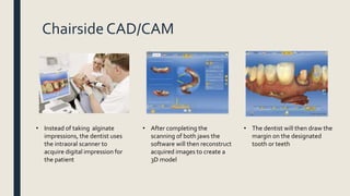 Chairside CAD/CAM
• Instead of taking alginate
impressions, the dentist uses
the intraoral scanner to
acquire digital impression for
the patient
• After completing the
scanning of both jaws the
software will then reconstruct
acquired images to create a
3D model
• The dentist will then draw the
margin on the designated
tooth or teeth
 