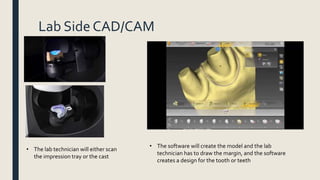 Lab Side CAD/CAM
• The lab technician will either scan
the impression tray or the cast
• The software will create the model and the lab
technician has to draw the margin, and the software
creates a design for the tooth or teeth
 