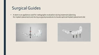 Surgical Guides
• A stent is an appliance used for radiographic evaluation during treatment planning
for implant placement and during surgical procedures to locate optimal implant placement site
 