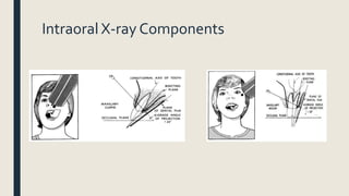 Intraoral X-ray Components
 