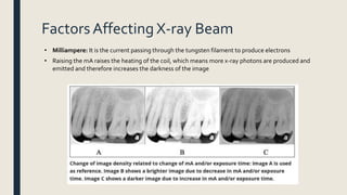 Factors Affecting X-ray Beam
• Milliampere: It is the current passing through the tungsten filament to produce electrons
• Raising the mA raises the heating of the coil, which means more x-ray photons are produced and
emitted and therefore increases the darkness of the image
 
